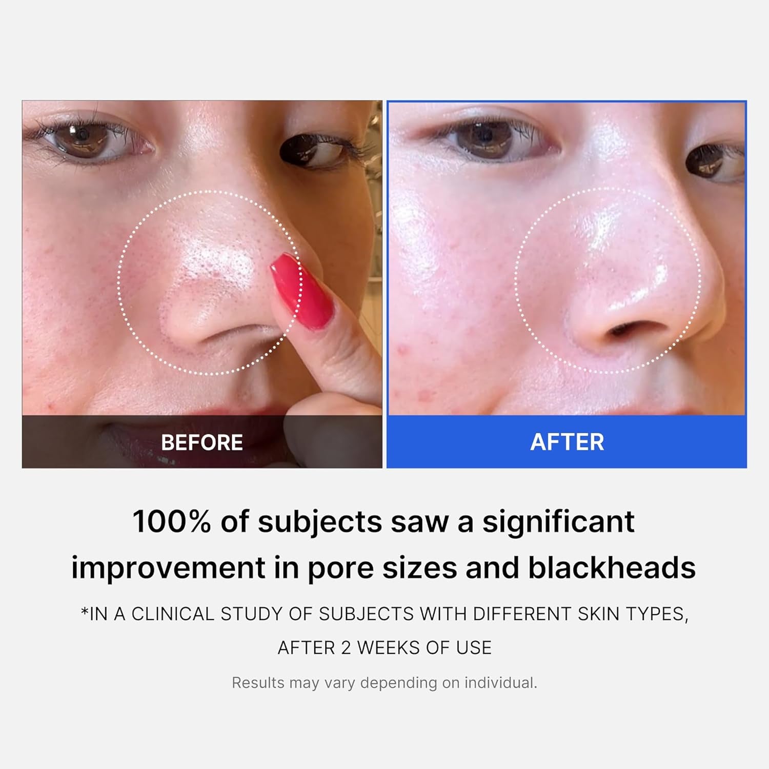 [] Zero Pore Pad 2.0 155G (70 Pads)